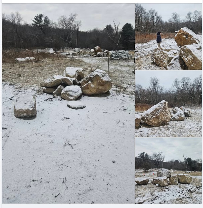 stone removal Jan 2026